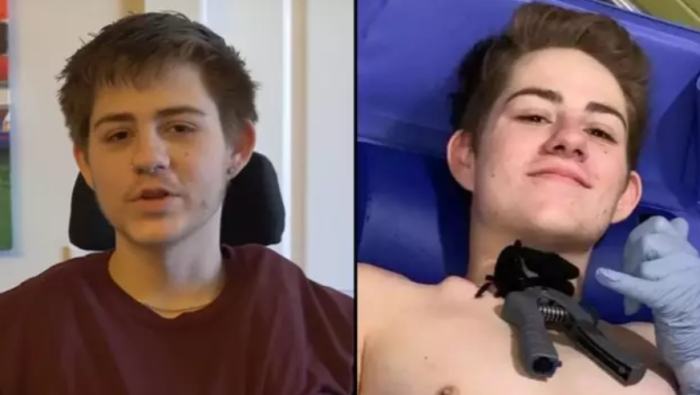 After Being Split in Two by a Forklift After Being Split in Two by a Forklift