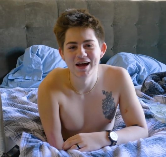 After Being Split in Two by a Forklift After Being Split in Two by a Forklift