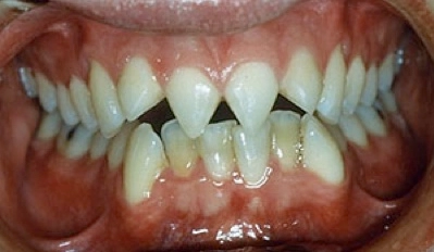 Forbidden Modifications: Top 10 Procedures You Won't Believe Are Real.